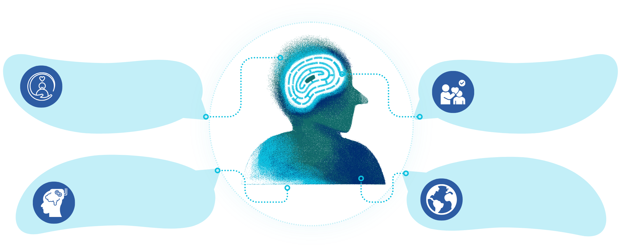 Ilustración de la estimulación magnética transcraneal sobre el cerebro